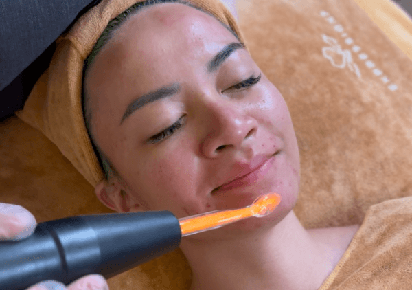 Acne Clearance Facial Treatment