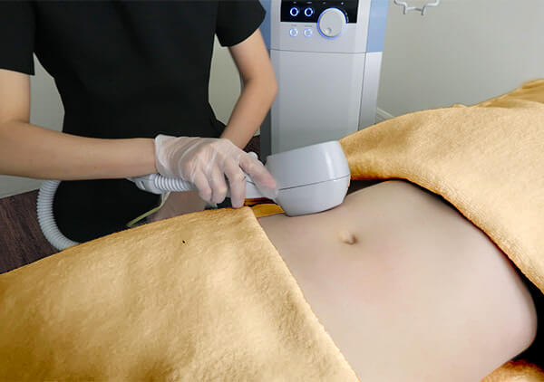 Exilis Body Contouring Treatment by Expressions